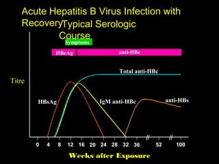 Acute Hepatitis B Virus Infection with
   RecoveryTypical Serologic
          Course
                    Symptoms
                HBeAg                anti-HBe


                                     Total anti-HBc
Titre

        HBsAg                  IgM anti-HBc            anti-HBs




        0   4   8   12 16 20 24 28 32 36          52      100

                     Weeks after Exposure
 