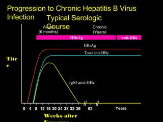 Progression to Chronic Hepatitis B Virus
Infection  Typical Serologic
           Course
          Acute          Chronic
              (6 months)                   (Years)
                            HBeAg                      anti-HBe
                                    HBsAg
                                    Total anti-HBc
Titr
e


                           IgM anti-HBc




       0 4 8 12 16 20 24 28 32 36     52             Years
                Weeks after
 