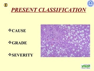 PRESENT CLASSIFICATION


CAUSE
            Liver007.jpg




GRADE

SEVERITY
 