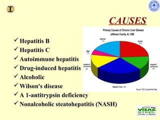 CAUSES
 Hepatitis B
 Hepatitis C
 Autoimmune hepatitis
 Drug-induced hepatitis
 Alcoholic
 Wilson's disease
 A 1-antitrypsin deficiency
 Nonalcoholic steatohepatitis (NASH)
 