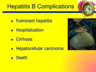  Fulminant hepatitis
 Hospitalization
 Cirrhosis
 Hepatocellular carcinoma
 Death
Hepatitis B Complications
 