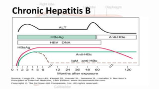 Chronic hepatitis b | PPTX