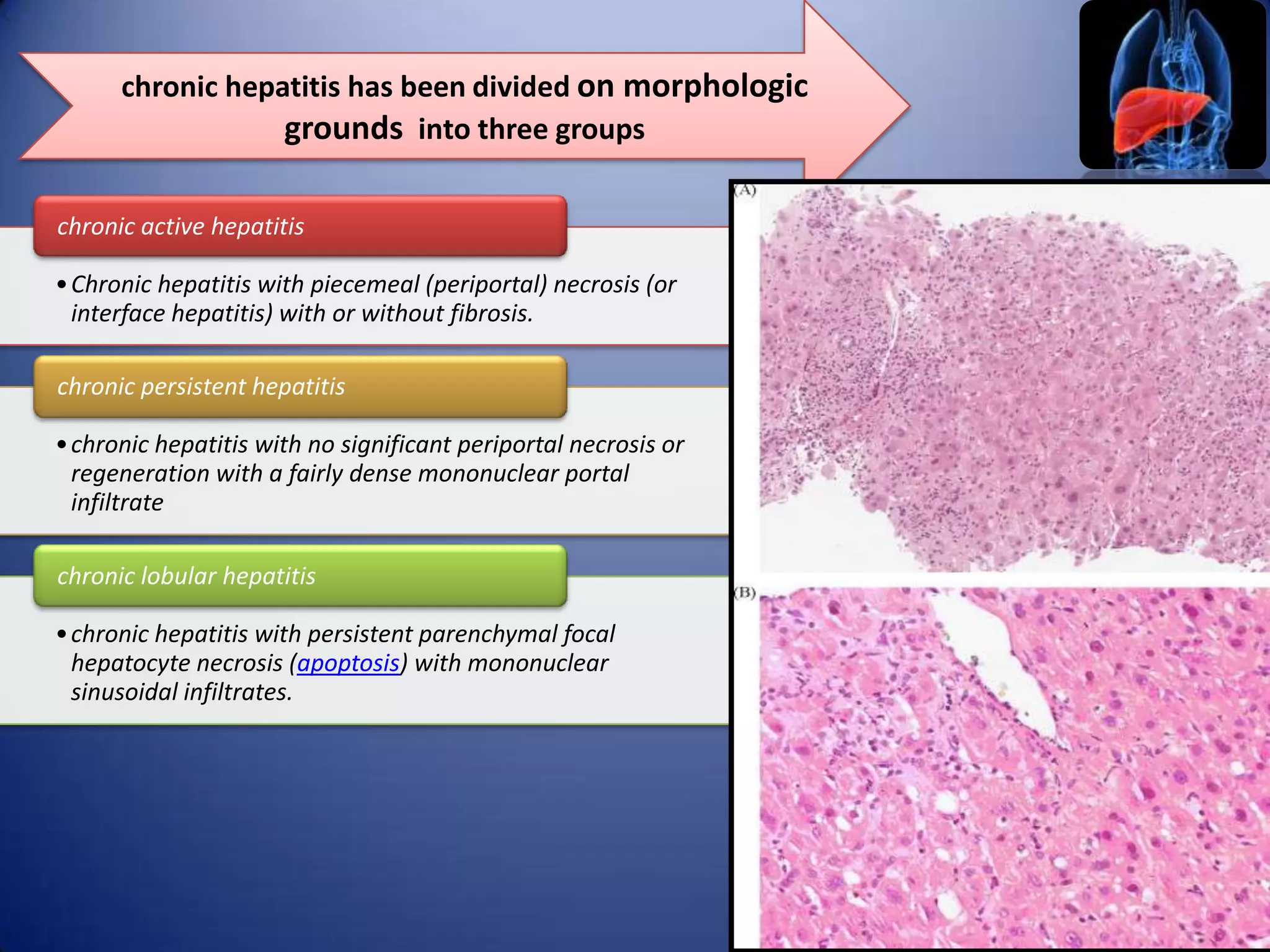 chronic hepatitis has been divided on morphologic
grounds into three groups
chronic active hepatitis
• Chronic hepatitis with piecemeal (periportal) necrosis (or
interface hepatitis) with or without fibrosis.
chronic persistent hepatitis

• chronic hepatitis with no significant periportal necrosis or
regeneration with a fairly dense mononuclear portal
infiltrate
chronic lobular hepatitis
• chronic hepatitis with persistent parenchymal focal
hepatocyte necrosis (apoptosis) with mononuclear
sinusoidal infiltrates.

 