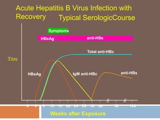 Symptoms
HBeAg anti-HBe
Total anti-HBc
IgM anti-HBc anti-HBsHBsAg
0 4 8 12 16 20 24 28 32 36 52 100
Acute Hepatitis B Virus Infection with
Recovery Typical SerologicCourse
Weeks after Exposure
Titre
 
