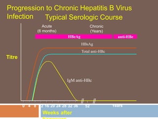 IgM anti-HBc
Total anti-HBc
HBsAg
Acute
(6 months)
HBeAg
Chronic
(Years)
anti-HBe
0 4 8 12 16 20 24 28 32 36 52 Years
Weeks after
Titre
Progression to Chronic Hepatitis B Virus
Infection Typical Serologic Course
 