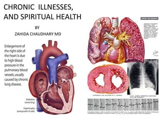 https://image.slidesharecdn.com/chronicilnesses-140120150516-phpapp01/85/educational-grand-rounds-chronic-illnesses-and-spiritual-health-1-320.jpg?cb=1669914145