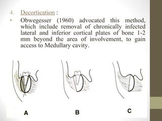 7. Continuous or intermittent indwelling closed
catheter irrigation:
• After sequestrectomy or decortication, 2
polyethyle...