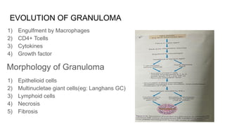EVOLUTION OF GRANULOMA
1) Engulfment by Macrophages
2) CD4+ Tcells
3) Cytokines
4) Growth factor
Morphology of Granuloma
1) Epithelioid cells
2) Multinucletae giant cells(eg: Langhans GC)
3) Lymphoid cells
4) Necrosis
5) Fibrosis
 