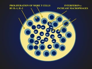 PROLIFERATION OF MORE T CELLS
BY IL-1, IL-2
INTERFERON-γ
INCREASE MACROPHAGES
 