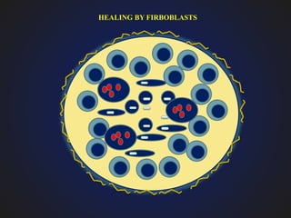 HEALING BY FIRBOBLASTS
 