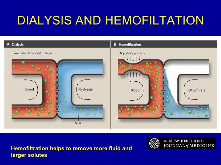 Chronic Kidney Disease