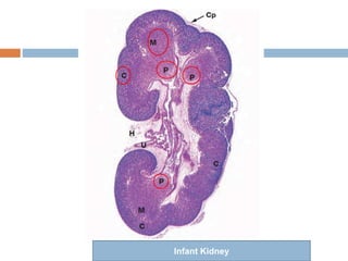 Infant Kidneys Chronic Kidney Disease.pptx
