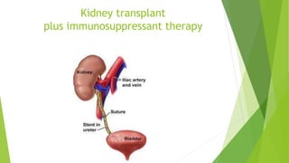 Kidney transplant
plus immunosuppressant therapy
 