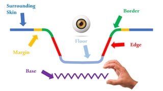 Surrounding
Skin
Margin
Base
Floor
Border
Edge
 