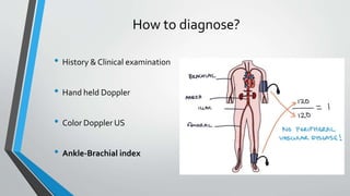 How to diagnose?
• History & Clinical examination
• Hand held Doppler
• Color Doppler US
• Ankle-Brachial index
 