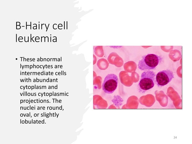 Picture of INTRODUCTION TO CHRONIC LEUKEMIA WHITE BLOOD CELLS MALIGNANCY | PPT