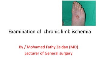 Examination of chronic limb ischemia
By / Mohamed Fathy Zaidan (MD)
Lecturer of General surgery
 