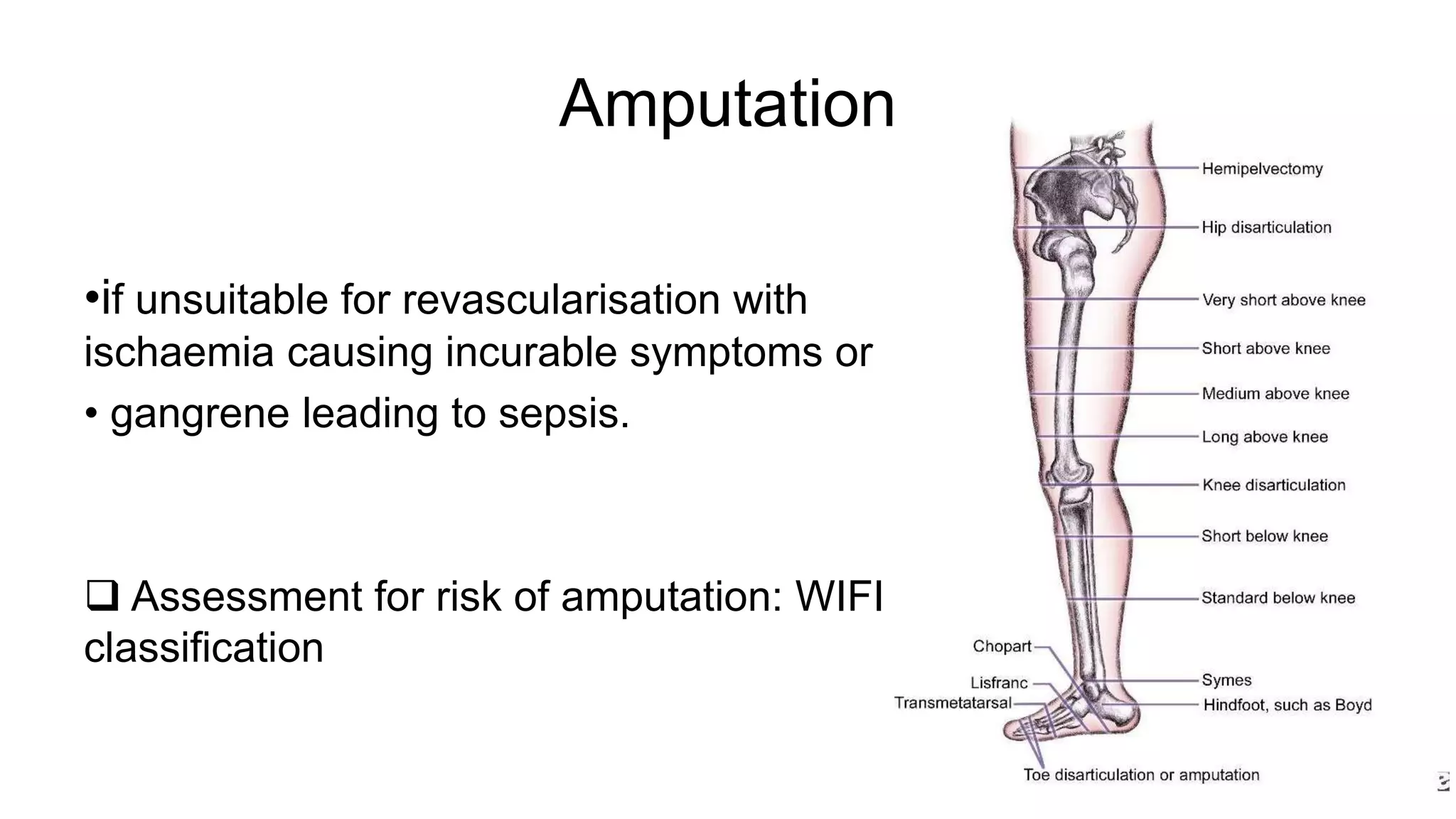 Wifi Classification Peripheral Vascular disease / Chronic limb ischemia / CLI / Acute limb ...
