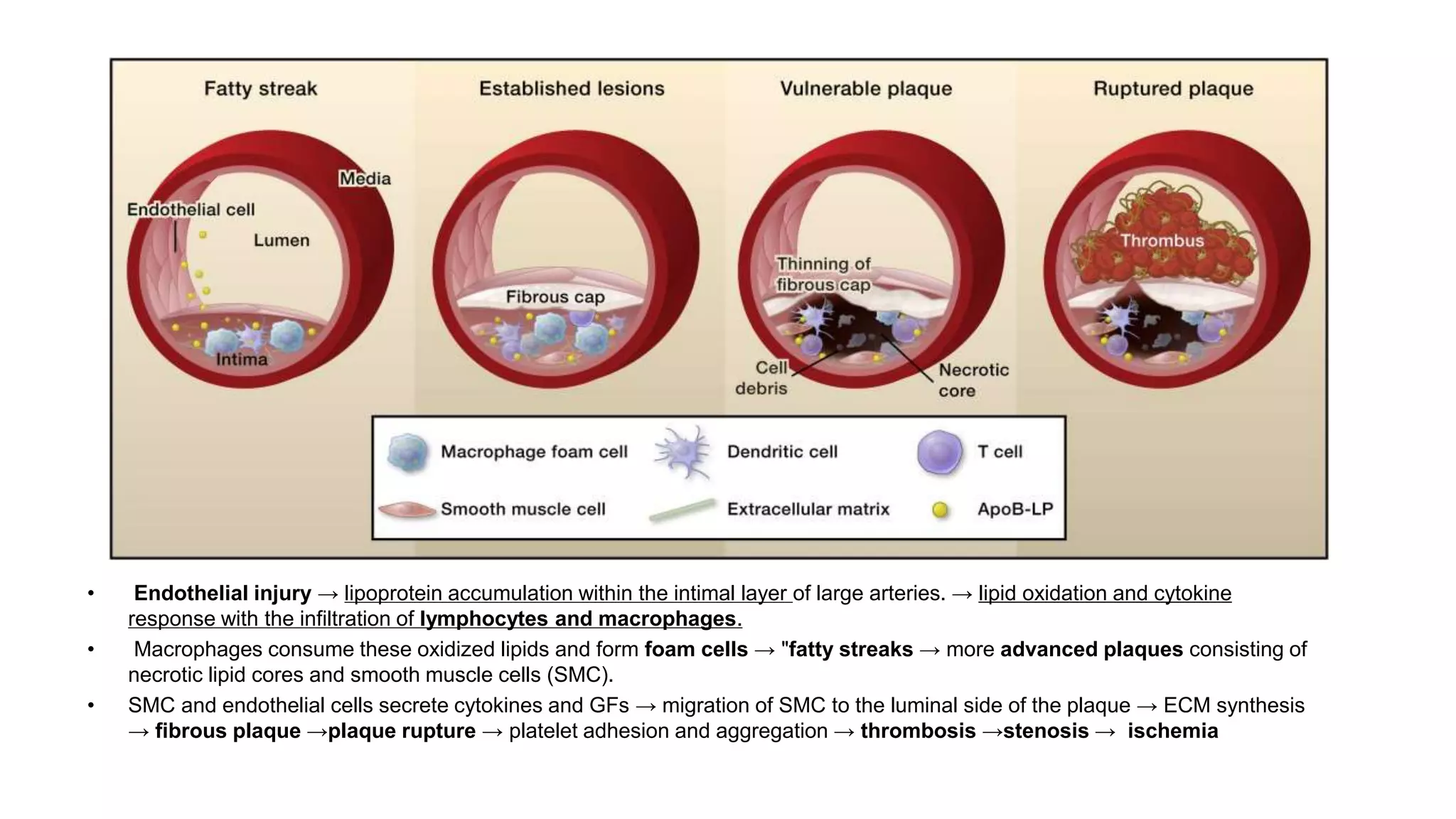 Peripheral Vascular disease / Chronic limb ischemia / CLI / Acute limb ...