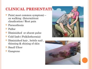 CLINICAL PRESENTATIONS
 Pain( most common symptom) –
on walking (Intermittent
claudication / Rest pain
 Paraesthesia
 Pallor
 Diminished or absent pulse
 Cold limb ( Poikilothermia)
 Diminished hair , brittle nail ,
thinning & shining of skin
 Small Ulcer
 Gangrene
 