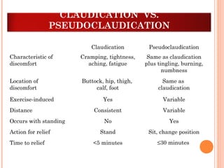 CLAUDICATION VS.
PSEUDOCLAUDICATION
Claudication Pseudoclaudication
Characteristic of
discomfort
Cramping, tightness,
aching, fatigue
Same as claudication
plus tingling, burning,
numbness
Location of
discomfort
Buttock, hip, thigh,
calf, foot
Same as
claudication
Exercise-induced Yes Variable
Distance Consistent Variable
Occurs with standing No Yes
Action for relief Stand Sit, change position
Time to relief <5 minutes ≤30 minutes
 