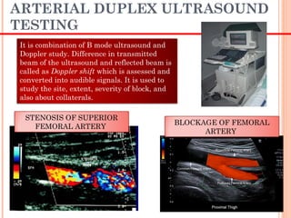 ARTERIAL DUPLEX ULTRASOUND
TESTING
However, the data
that might support
use of duplex
ultrasound to assess
long-term patency of
PTA is not robust.
STENOSIS OF SUPERIOR
FEMORAL ARTERY
BLOCKAGE OF FEMORAL
ARTERY
It is combination of B mode ultrasound and
Doppler study. Difference in transmitted
beam of the ultrasound and reflected beam is
called as Doppler shift which is assessed and
converted into audible signals. It is used to
study the site, extent, severity of block, and
also about collaterals.
 