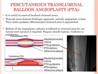 PERCUTANEOUS TRANSLUMINAL
BALLOON ANGIOPLASTY (PTA):
 It is useful in cases of localised stenosed areas.
 Through trans femoral Seldinger approach, initially angiogram is done.
Then under guidance (fluoroscopic) stenosed area is approached.
 Balloon of the angioplasty catheter is inflated at stenosed area for one
minute and repeated if required. Plaques should rupture. Catheter is
withdrawn.
 