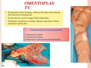 OMENTOPLAS
TY
 It promotes ulcer healing, reduces the pain and controls
the features of ischaemia.
 It can also be used in upper limb ischaemia.
 If patient continues to smoke, disease spreads to these
omental vessels also.
Complications of omentoplasty:
1.Abdominal sepsis.
2. Incisional hernia,
3.Adhesions and intestinal obstruction.
 