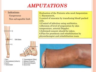 AMPUTATIONS
 Indications-
Gangrenous
Non salvageable limb
Evaluation of the Patients who need Amputation
1. Haematocrit,
2.control of anaemia by transfusing blood/ packed
cells.
3.Control of infection using antibiotics.
4.Decision of level of amputation by skin
temperature, arterial Doppler.
5.Informed consent should be taken.
6.Plan for prosthesis and rehabilitation by
physiotherapist and rehabilitation team.
 