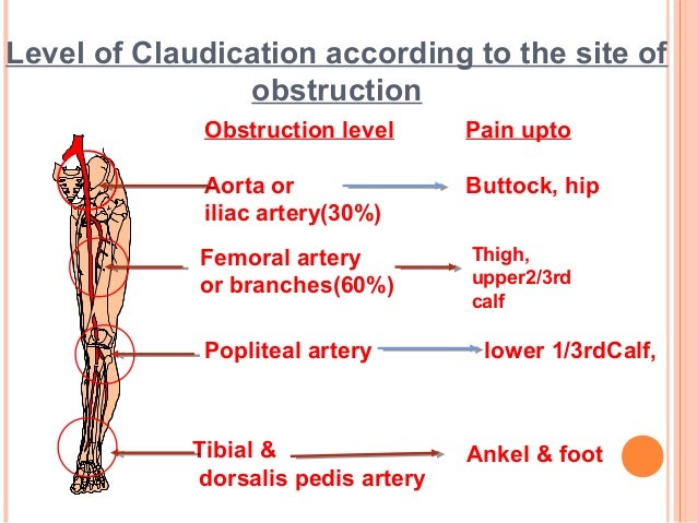 Chronic limb ischemia