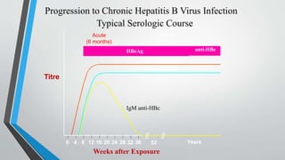 IgM anti-HBc
Total anti-HBc
HBsAg
Acute
(6 months)
HBeAg
Chronic
(Years)
anti-HBe
0 4 8 12 16 20 24 28 32 36 52 Years
Weeks after Exposure
Titre
Progression to Chronic Hepatitis B Virus Infection
Typical Serologic Course
 
