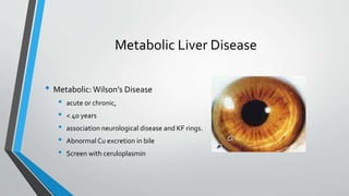 Metabolic Liver Disease
• Metabolic: Wilson’s Disease
• acute or chronic,
• < 40 years
• association neurological disease and KF rings.
• Abnormal Cu excretion in bile
• Screen with ceruloplasmin
 