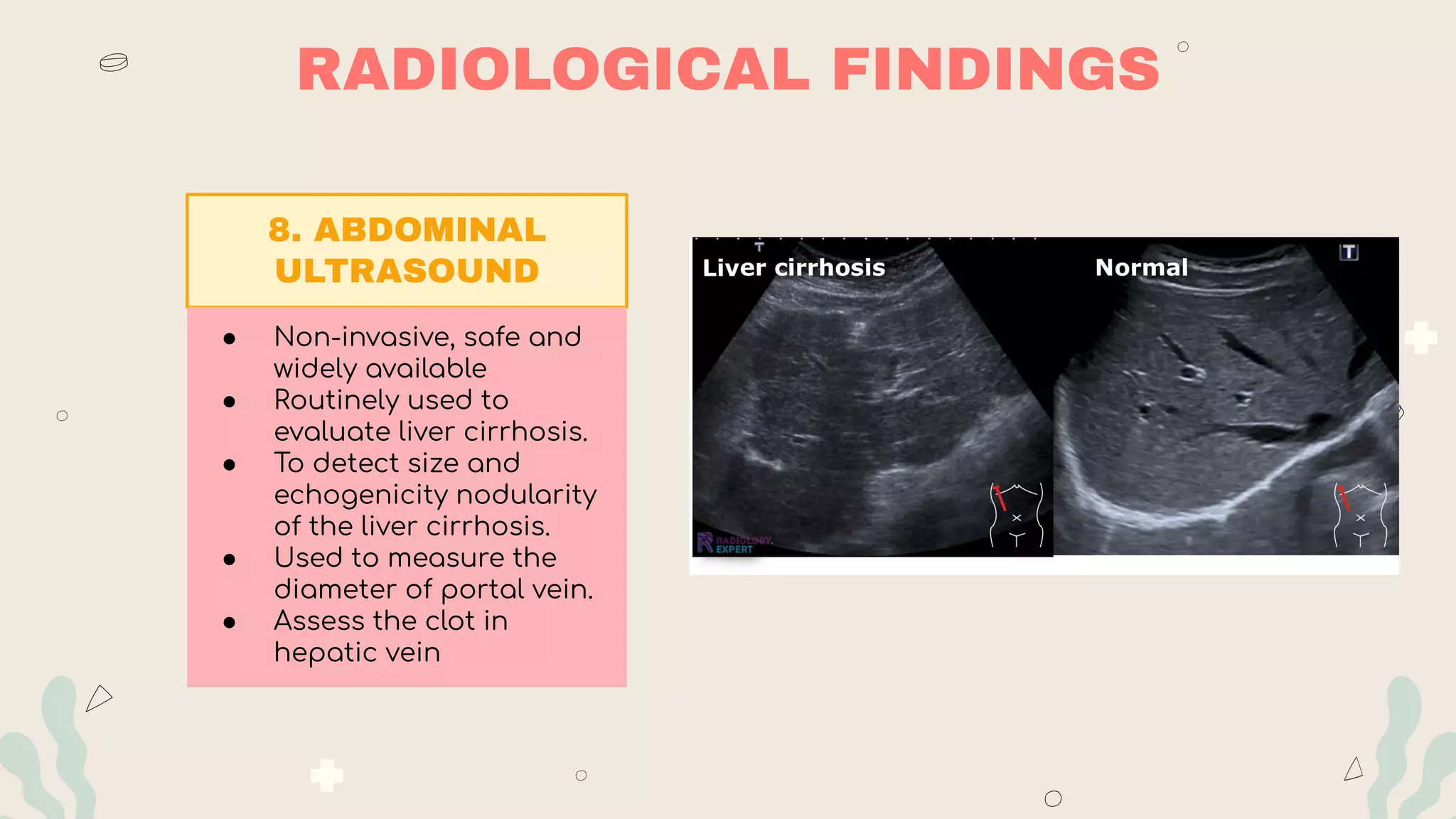 RADIOLOGICAL FINDINGS
8. ABDOMINAL
ULTRASOUND
● Non-invasive, safe and
widely available
● Routinely used to
evaluate liver cirrhosis.
● To detect size and
echogenicity nodularity
of the liver cirrhosis.
● Used to measure the
diameter of portal vein.
● Assess the clot in
hepatic vein
 