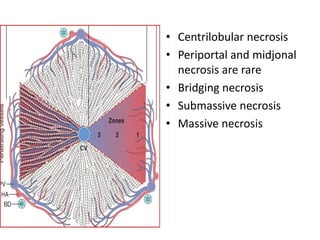 • Centrilobular necrosis
• Periportal and midjonal
  necrosis are rare
• Bridging necrosis
• Submassive necrosis
• Massive necrosis
 