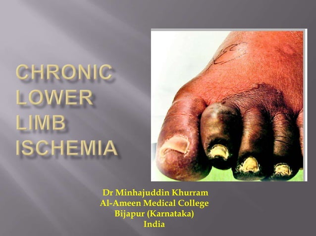 Chronic lower limb ischemia | PPTX | Blood Disorders | Diseases and ...