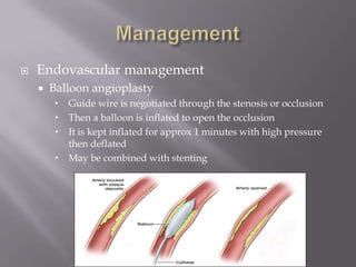  Endovascular management
 Balloon angioplasty
 Guide wire is negotiated through the stenosis or occlusion
 Then a balloon is inflated to open the occlusion
 It is kept inflated for approx 1 minutes with high pressure
then deflated
 May be combined with stenting
 