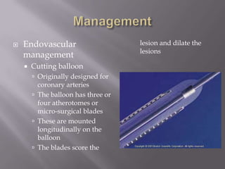  Endovascular
management
 Cutting balloon
 Originally designed for
coronary arteries
 The balloon has three or
four atherotomes or
micro-surgical blades
 These are mounted
longitudinally on the
balloon
 The blades score the
lesion and dilate the
lesions
 