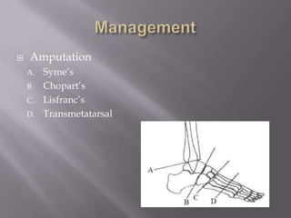  Amputation
A. Syme’s
B. Chopart’s
C. Lisfranc’s
D. Transmetatarsal
 