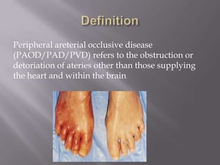 Peripheral areterial occlusive disease
(PAOD/PAD/PVD) refers to the obstruction or
detoriation of ateries other than those supplying
the heart and within the brain
 