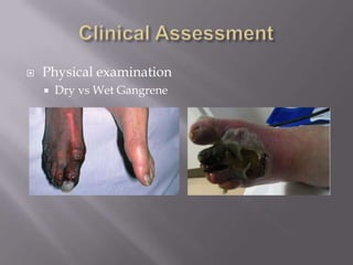  Physical examination
 Dry vs Wet Gangrene
 