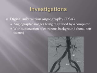  Digital subtraction angiography (DSA)
 Angiographic images being digitilised by a computer
 With substraction of extrenous background (bone, soft
tissues)
 