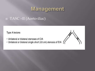  TASC –II (Aorto-iliac)
 