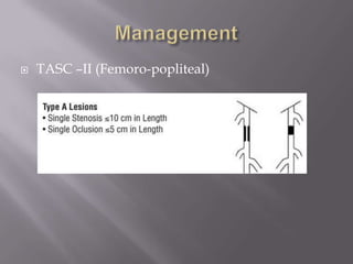  TASC –II (Femoro-popliteal)
 