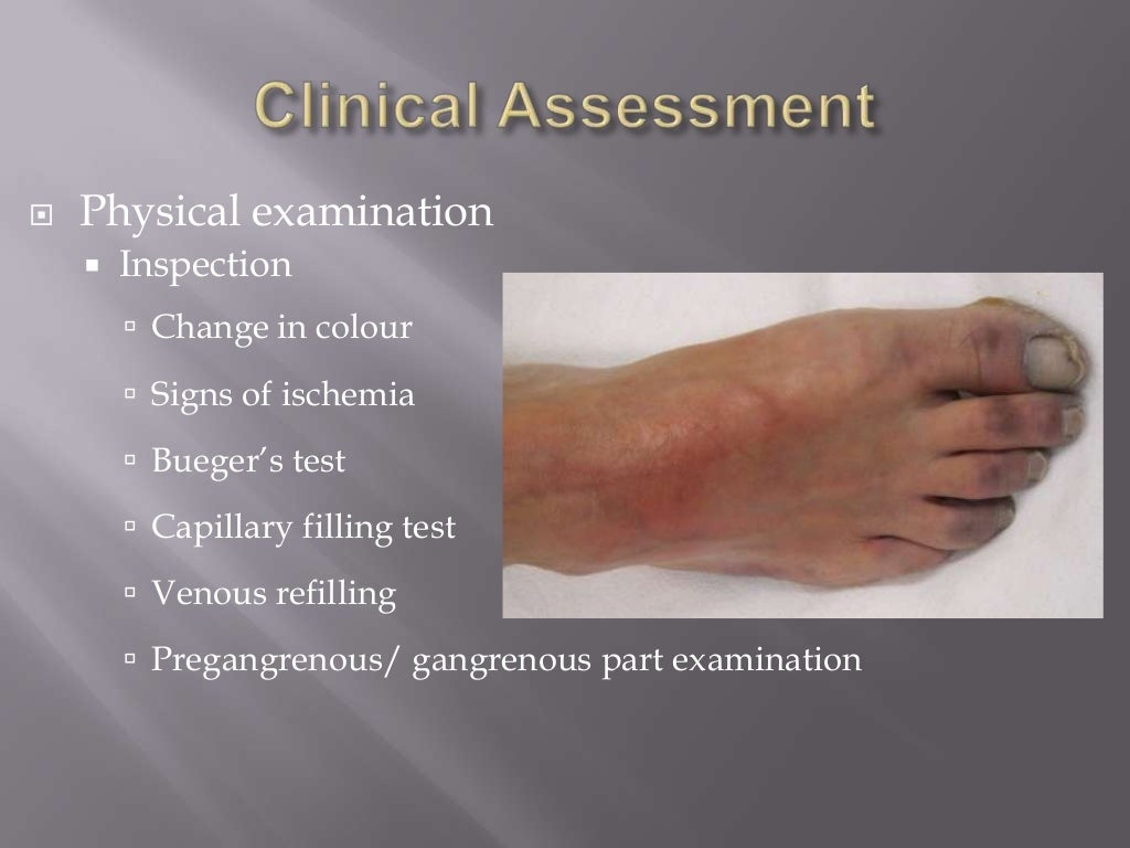 Chronic lower limb ischemia