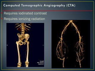 • Requires iodinated contrast
• Requires ionizing radiation
 