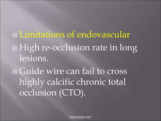  Limitations of endovascular
 High re-occlusion rate in long
lesions.
 Guide wire can fail to cross
highly calcific chronic total
occlusion (CTO).
WWW.SMSO.NET
 