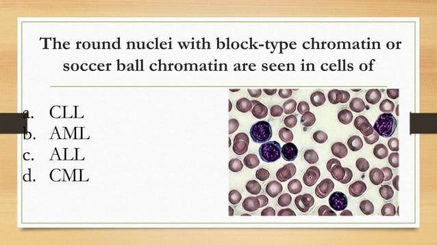 Chronic Lymphocytic Leukemia (CLL) | PPTX