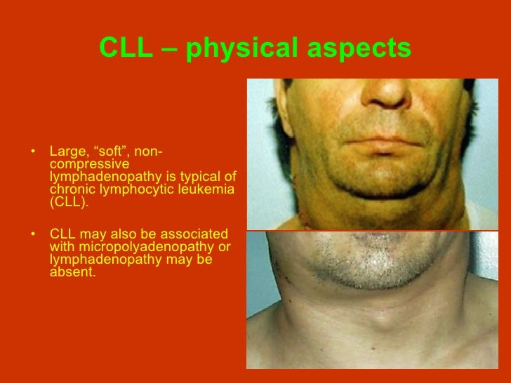 epub Post epub Post Transcriptional