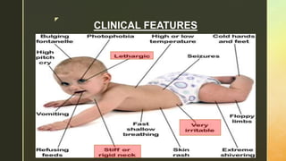 z
CLINICAL FEATURES
 