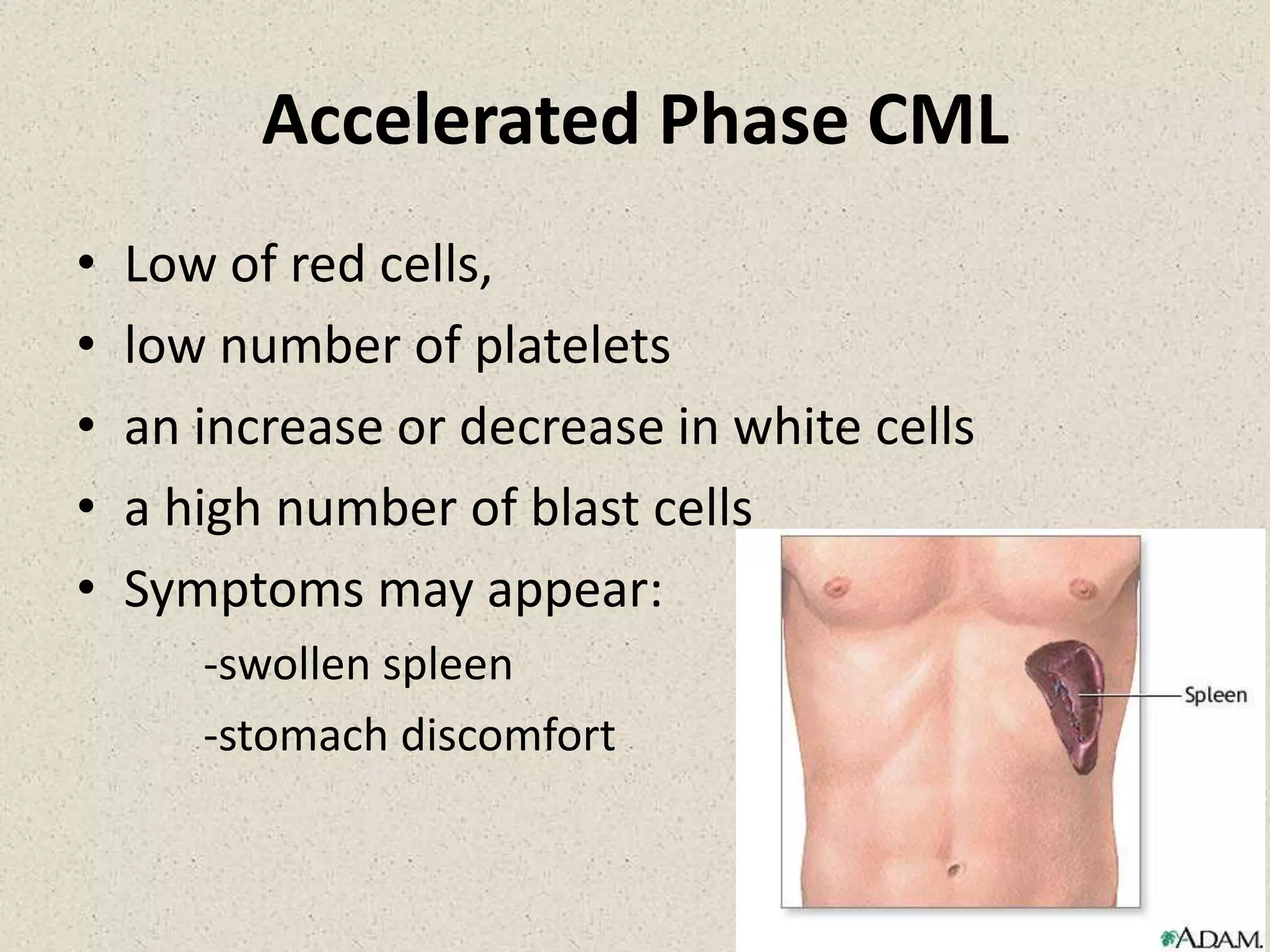 Chronic myeloid leukemia | PPTX